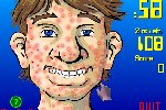 Eclater les boutons d'acne